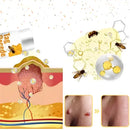 [PAGUE 1, LLEVA 2] TAG RECEDE - REMOVEDOR DE VERRUGAS