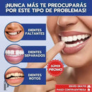[PAGA 1 y LLEVA 2] CARILLAS DENTALES AJUSTABLES - SNAP-ON SMILE