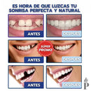 [PAGA 1 y LLEVA 2] CARILLAS DENTALES AJUSTABLES - SNAP-ON SMILE